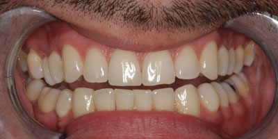 Ortho1-After
